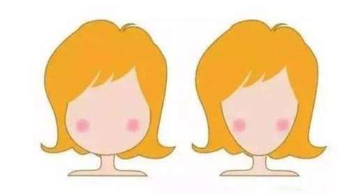 刮骨瘦脸贵不贵？费用影响因素、手术原理及优缺点、术后注意事项